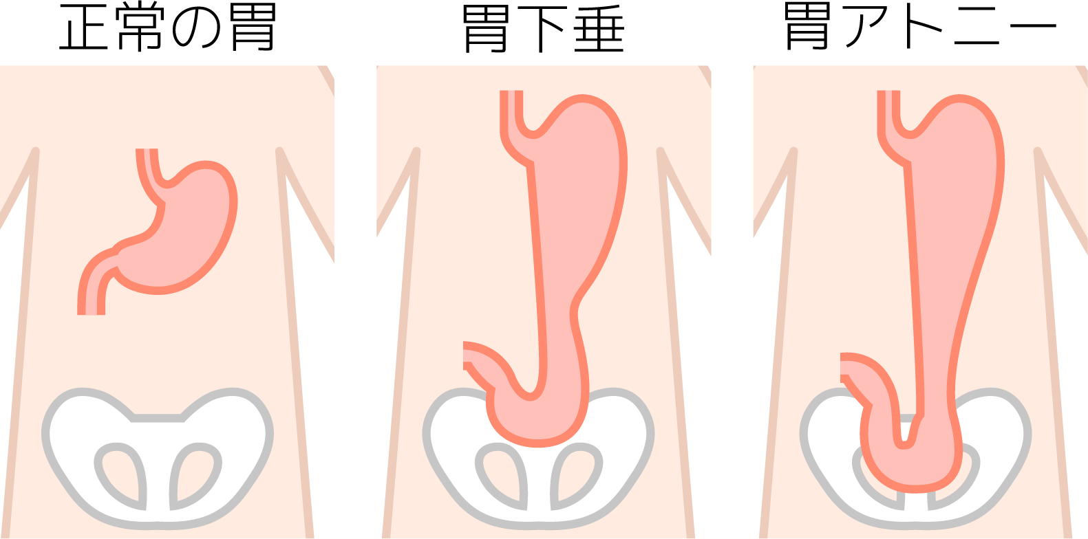 正常な位置よりも 垂れ下がっている状態