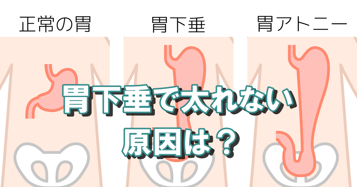 胃下垂で太れない…原因と太る方法は？